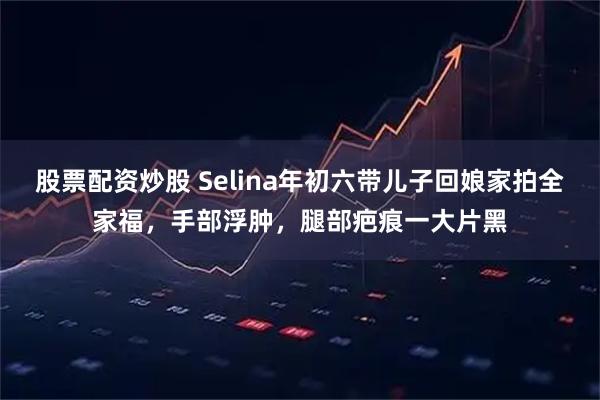 股票配资炒股 Selina年初六带儿子回娘家拍全家福，手部浮肿，腿部疤痕一大片黑